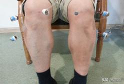 艾灸专家讲艾灸疗效,在家艾灸哪种灸法效果最好