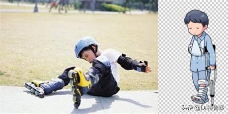 骨折久不愈合做冲击波有效吗,冲击波对骨不愈合有帮助吗