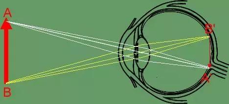 打球撞到眼睛有瘀血怎么快速消,打球被撞伤眼睛视力下降