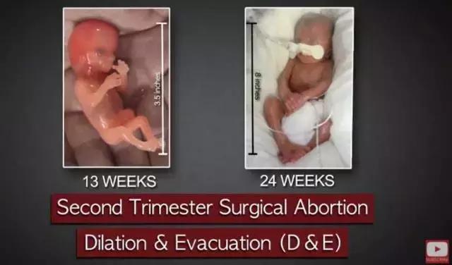 丁嘉丽明星的故事,丁嘉丽央视