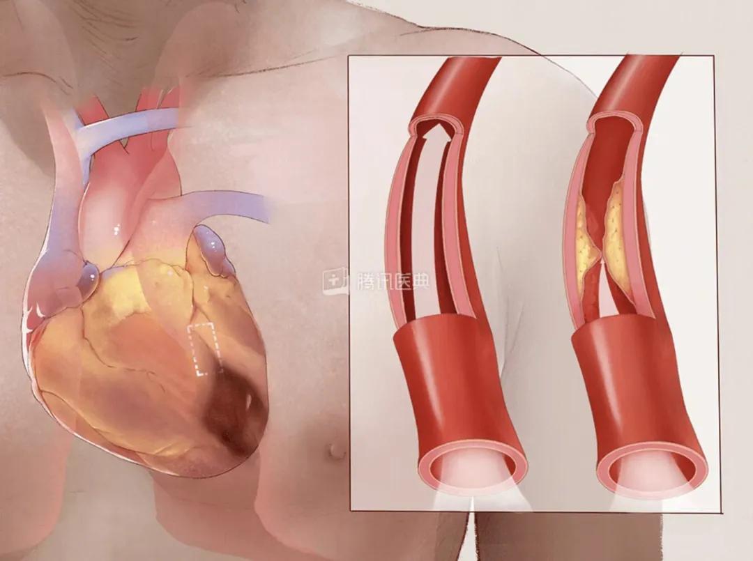 “我的心又不疼！”香港老板忙着上市，却被深圳医生“拖”住！