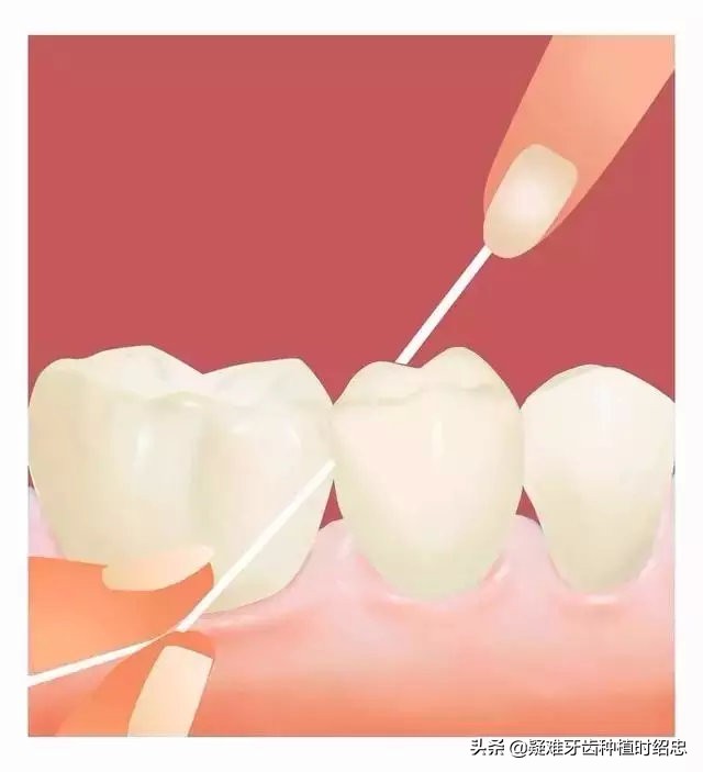 牙缝大是福是祸,牙缝宽什么命运