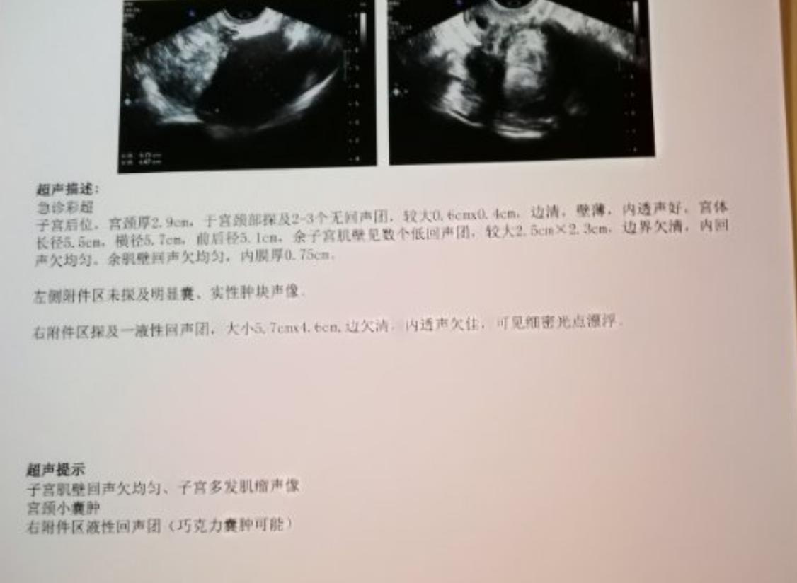 妇科腺肌症,子宫腺肌症可以吃妇科再造丸吗