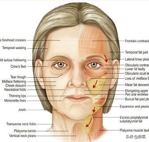 戴牙套真的会出现牙套脸,戴牙套期间牙齿变龅了