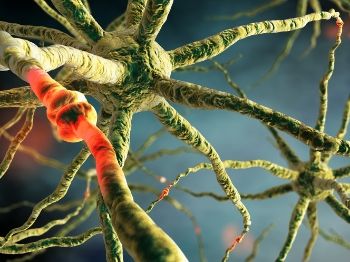 带状疱疹性神经痛应该吃哪些食物,甲钴胺对带状疱疹性神经痛有效吗