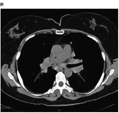 胸部影像解剖图谱书,胸部断层图谱