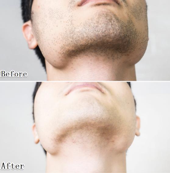 小米再发剃须刀，89块干翻千元大牌？穷人福音