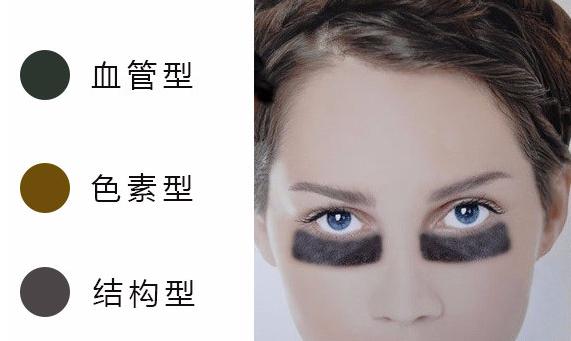 黑眼圈显憔悴教你5种方法来消除,黑眼圈很重气色很差怎么改善