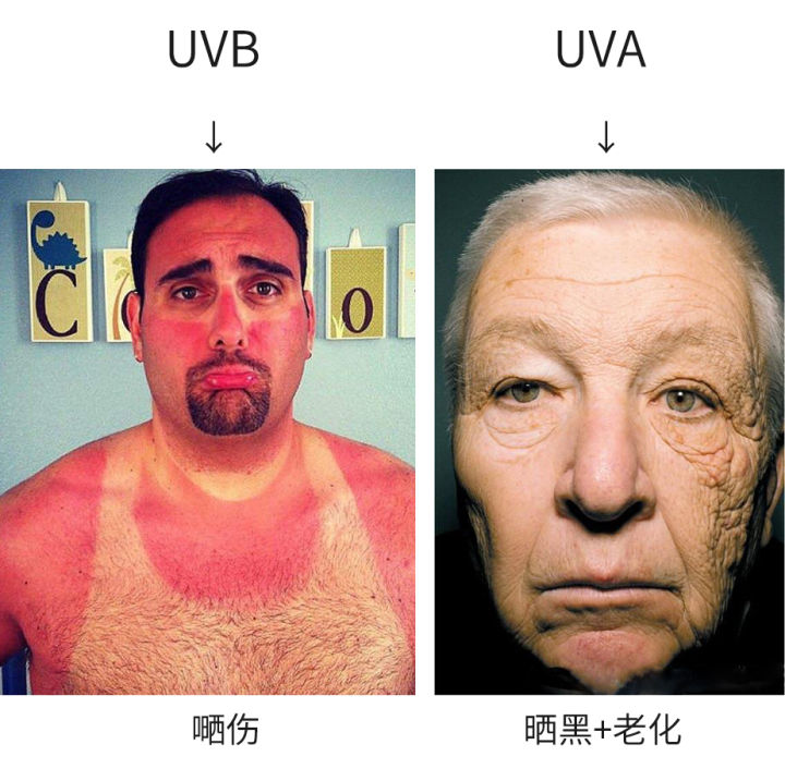 脖子被太阳晒黑了怎么才能变白,被太阳晒黑怎样变白女生