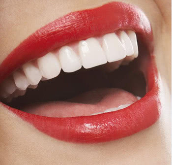 全瓷贴面修复的优缺点,想做牙齿贴面优缺点你知道吗