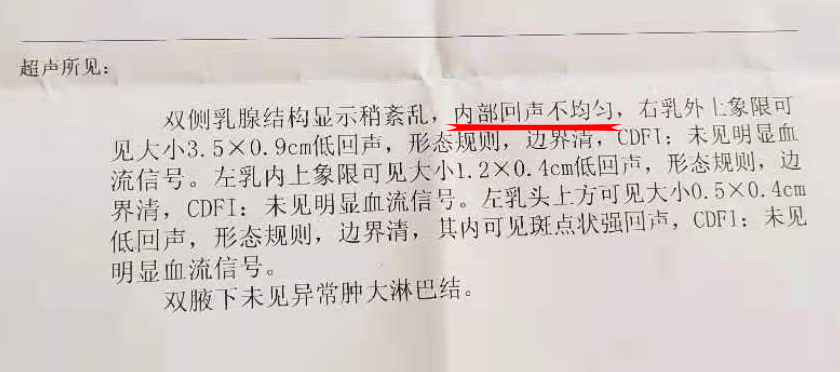 乳腺结构紊乱回声不均是什么意思,乳腺报告回声不均呈豹纹状