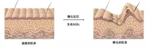 明星都在“戒糖”岛国大火的抗糖丸，到底怎么样？