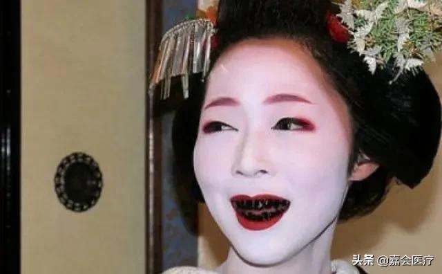 怎么不露齿笑才自然好看,如何笑不露齿笑起来好看的技巧