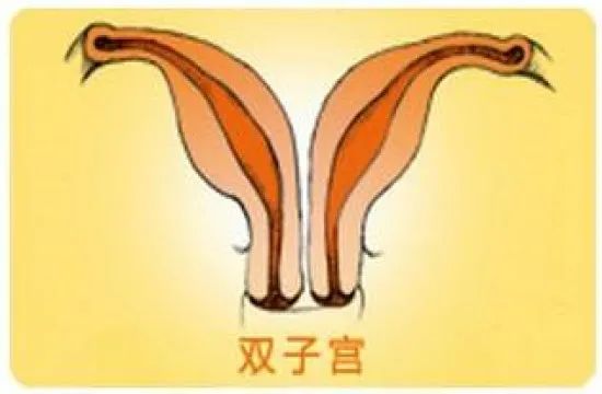 子宫畸形真实故事,子宫的故事绘本