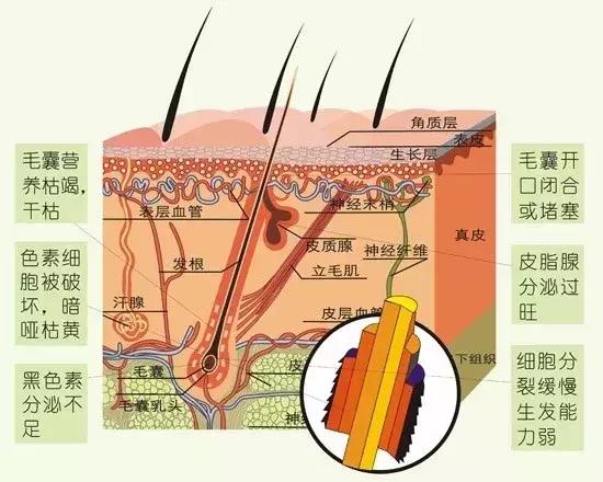 一个秃头的自救经验：最有效的“生发剂”只有这几种