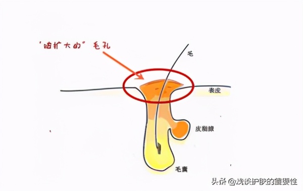 鼻子上收缩毛孔最有效的方法,鼻子毛孔大怎么办收缩毛孔