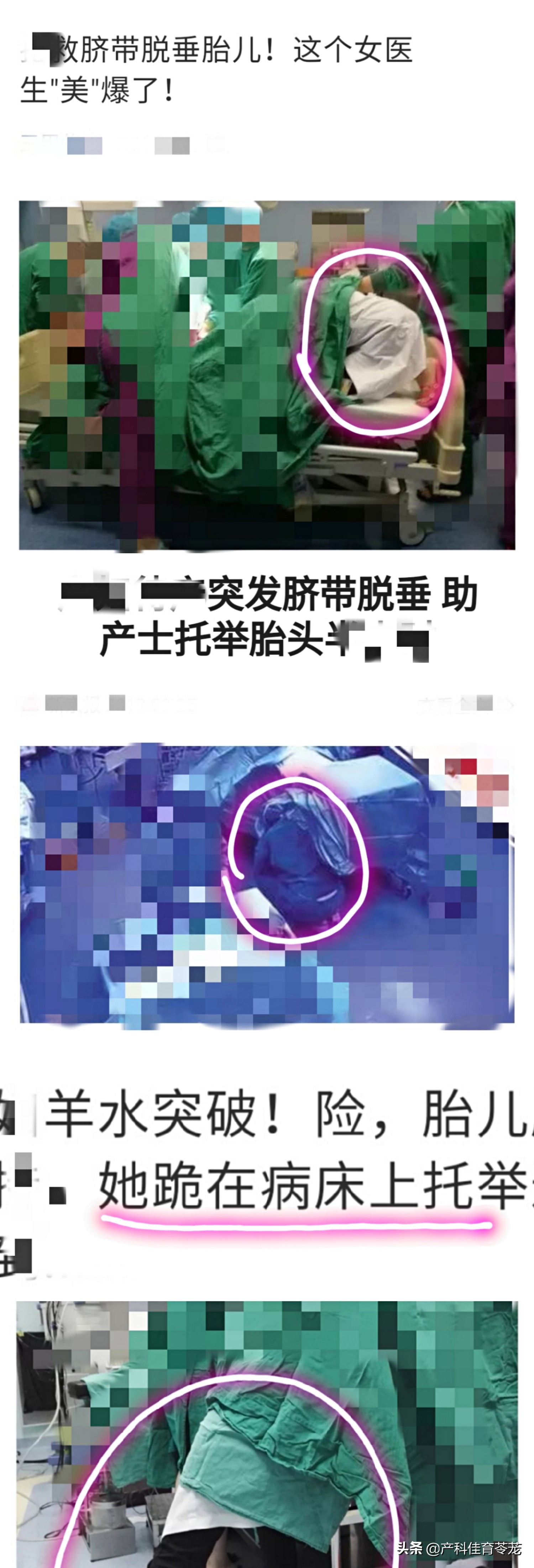 脐带脱垂,破水以后最害怕的事儿
