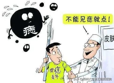 点痣到哪点比较好,原来点痣那么简单