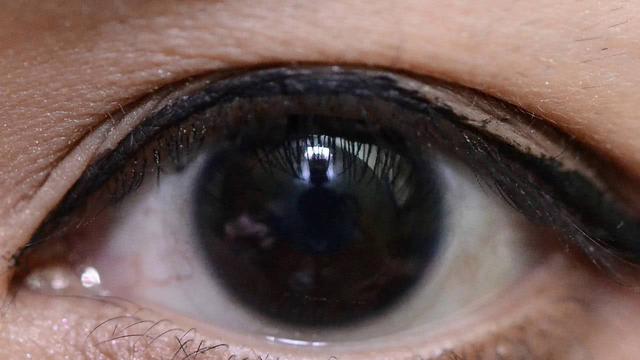 瞳色会因为受伤而改变吗,瞳色浅有什么危害