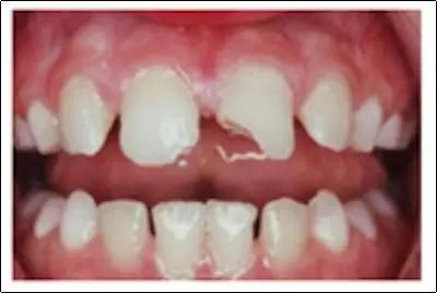 牙痛小知识科普,牙痛小常识分享给大家