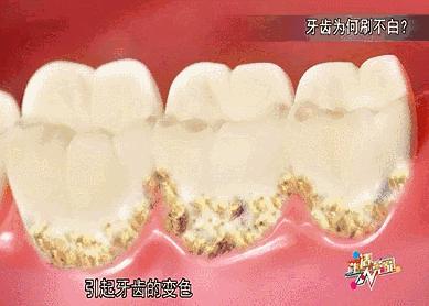 李沁牙膏真的有效果吗,李沁的黄牙变白了