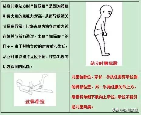 四川脑瘫康复训练有效果吗,成都脑瘫恢复中心
