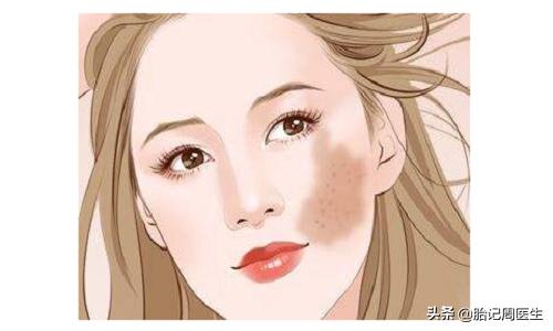经常喝咖啡真的会导致脸上长斑吗,小孩脸上有咖啡斑怎么办