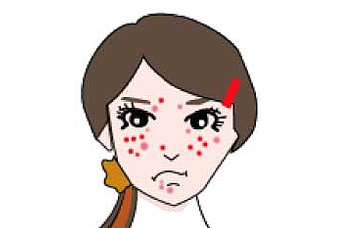 修丽可淡化痘印推荐,修丽可哪款祛黑痘印