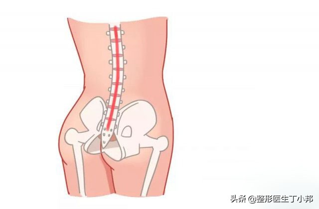 刚生完宝宝肚子有一块硬硬的,生了宝宝后肚子松弛怎么恢复