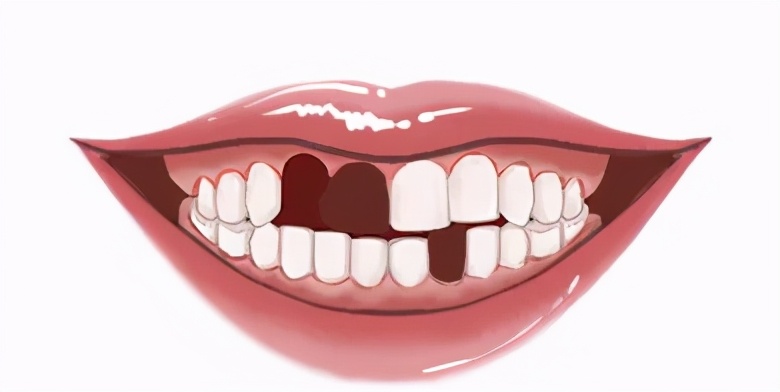 种牙是通过什么原理让它牢固的,种牙种钉过程