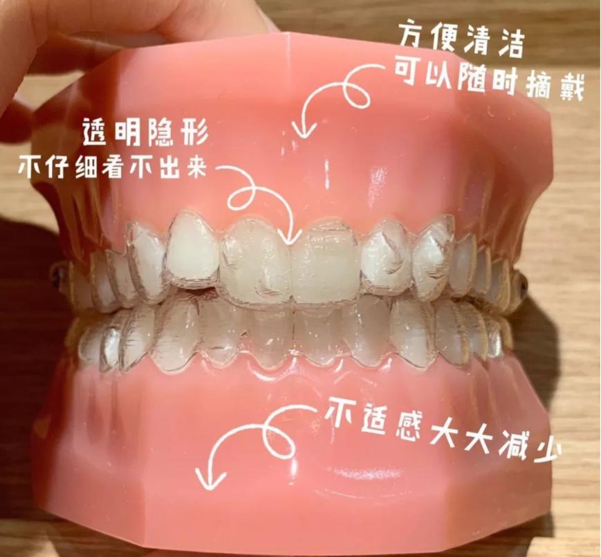 为啥进行牙齿矫正价钱不一样,最好的牙齿矫正需要多少钱