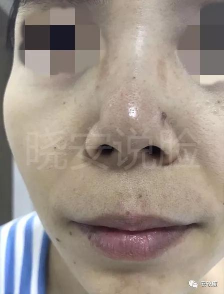 熟龄肌抗皱护肤品,35岁以上好用的抗老抗皱紧致测评