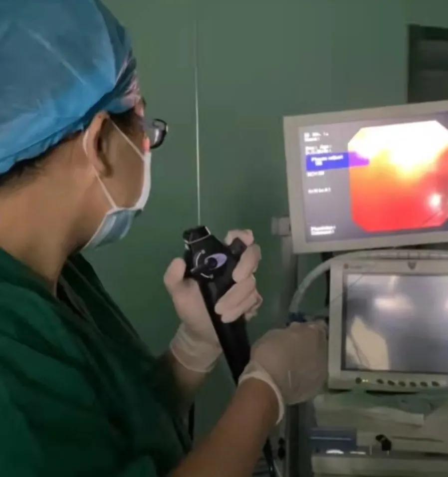 双镜联合手术,双镜联合保胆取息肉术