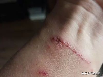 @云浮人虫出没，请注意！