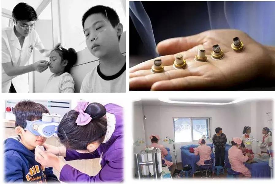 近视手术无法治愈近视,小孩近视能治愈吗