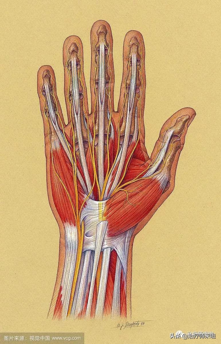腕管综合征严重了可以不做手术吗,腕管综合征不治疗能养好吗
