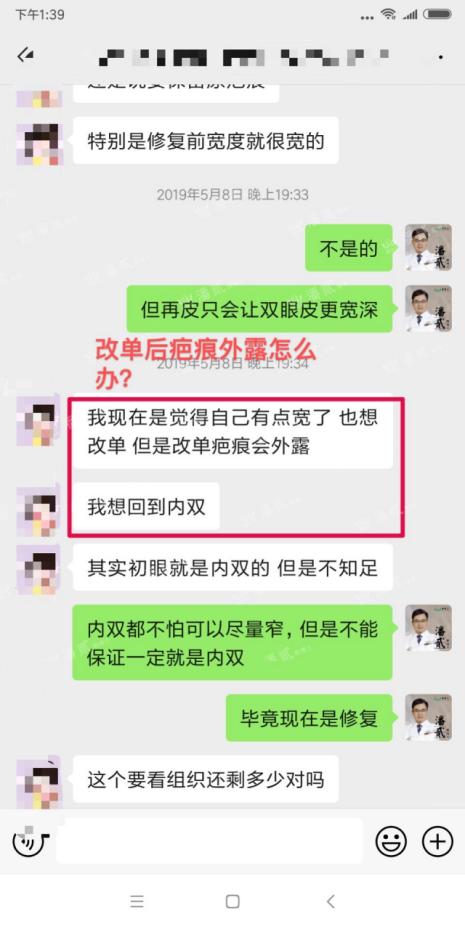 眼角下垂做双眼皮手术可以改变吗,后悔做双眼皮
