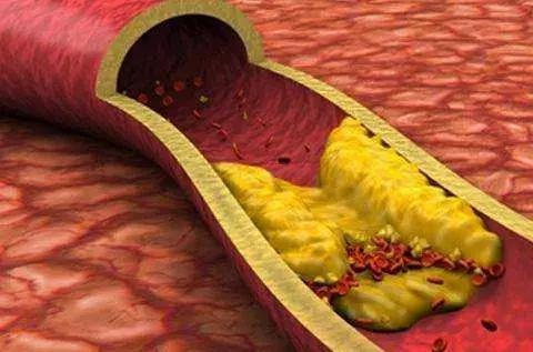 红曲米怎么吃降血脂最好,红曲米可降血脂是真的吗