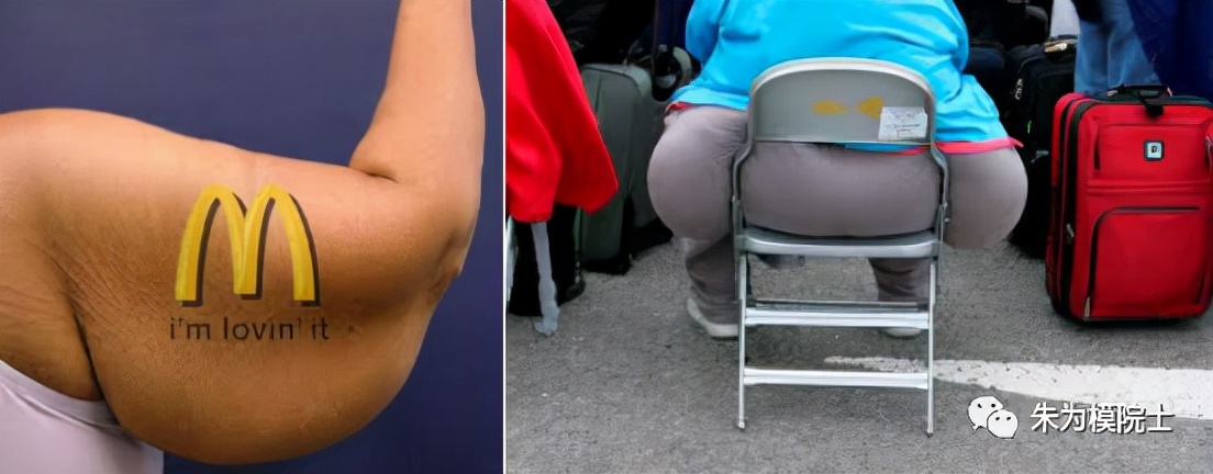 中风健康小知识,中风西医怎么预防