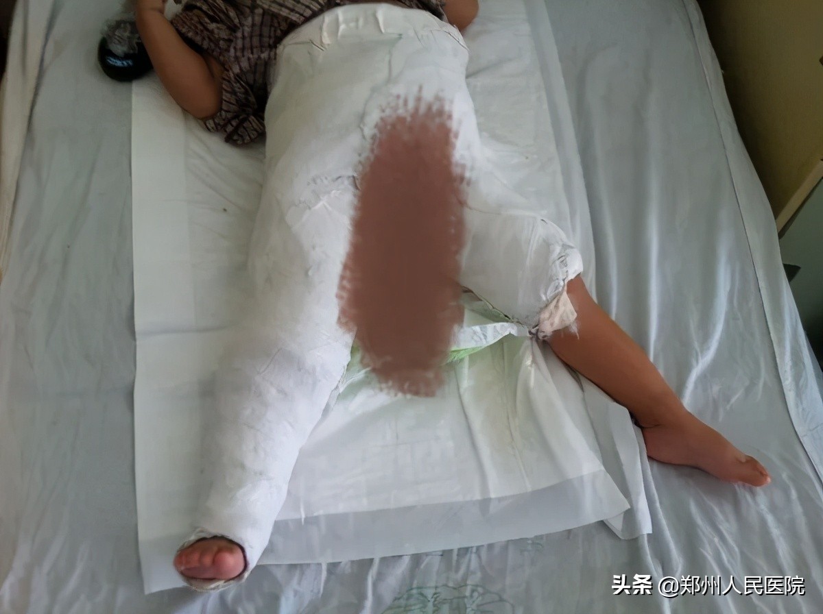 走路像鸭子一样摇摆,走路像鸭子的样子