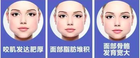 你的“包子脸”,或许我能帮你消灭它?!