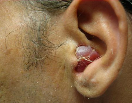 为什么会耳聋？耳聋能治疗吗？