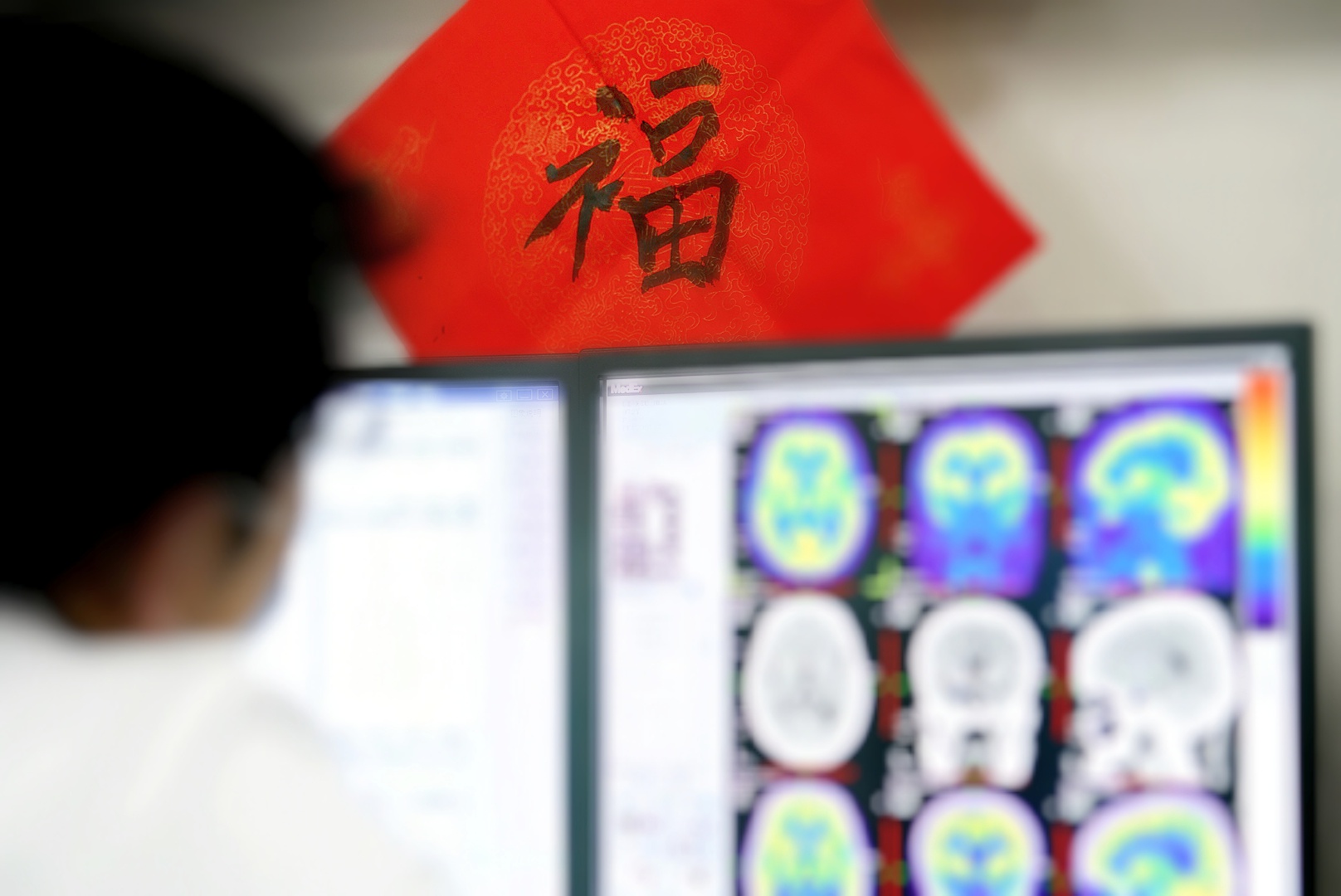 别再因为害怕放疗的副作用而拒绝治疗了