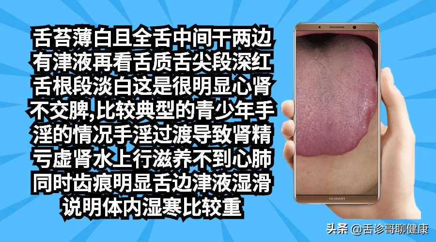 舌诊哥聊健康痰湿,抖音舌诊哥舌象分析与感悟