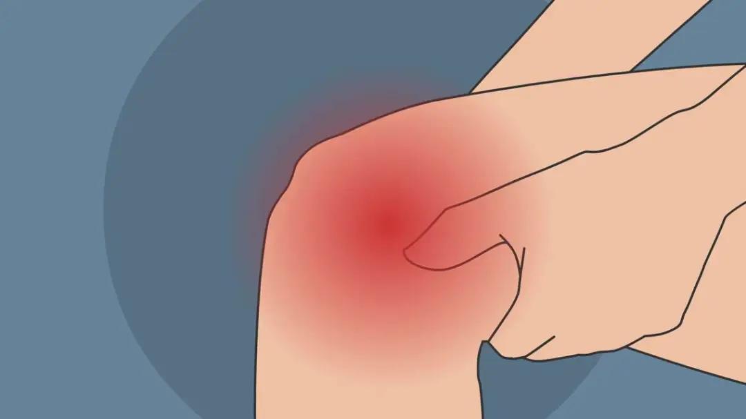 「医生告诉你」初三学子一开学就骨折！刚返校切勿“报复性运动”