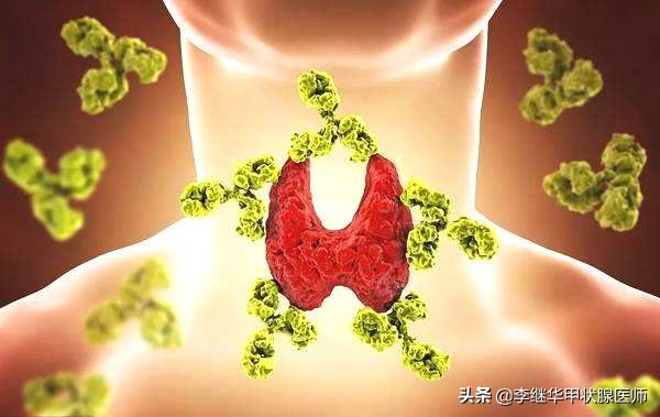 桥本氏甲减为什么医生不建议治疗,桥本氏亚甲减需要吃药吗