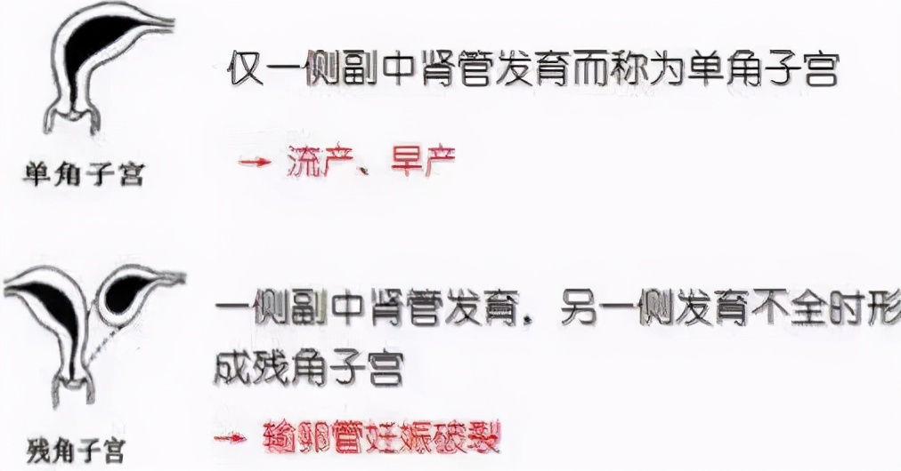 专家介绍子宫畸形种类,子宫疾病的介绍