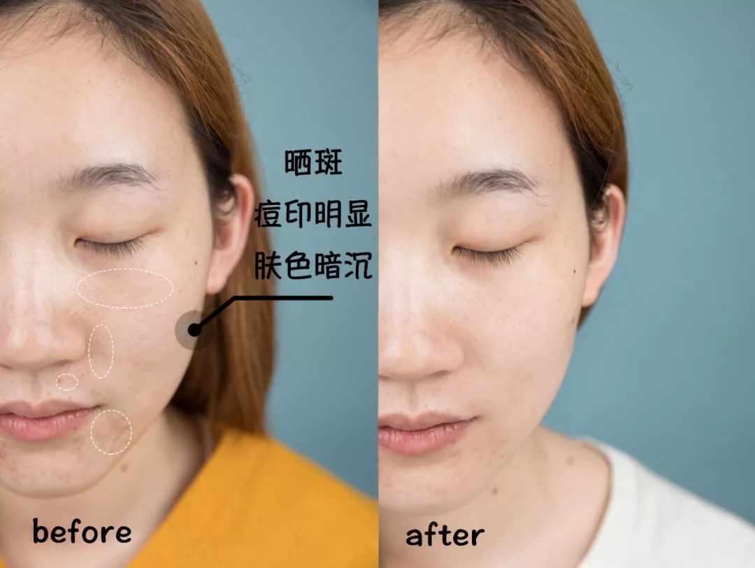 90后隐形贫困人口自救,90后隐形贫困人口