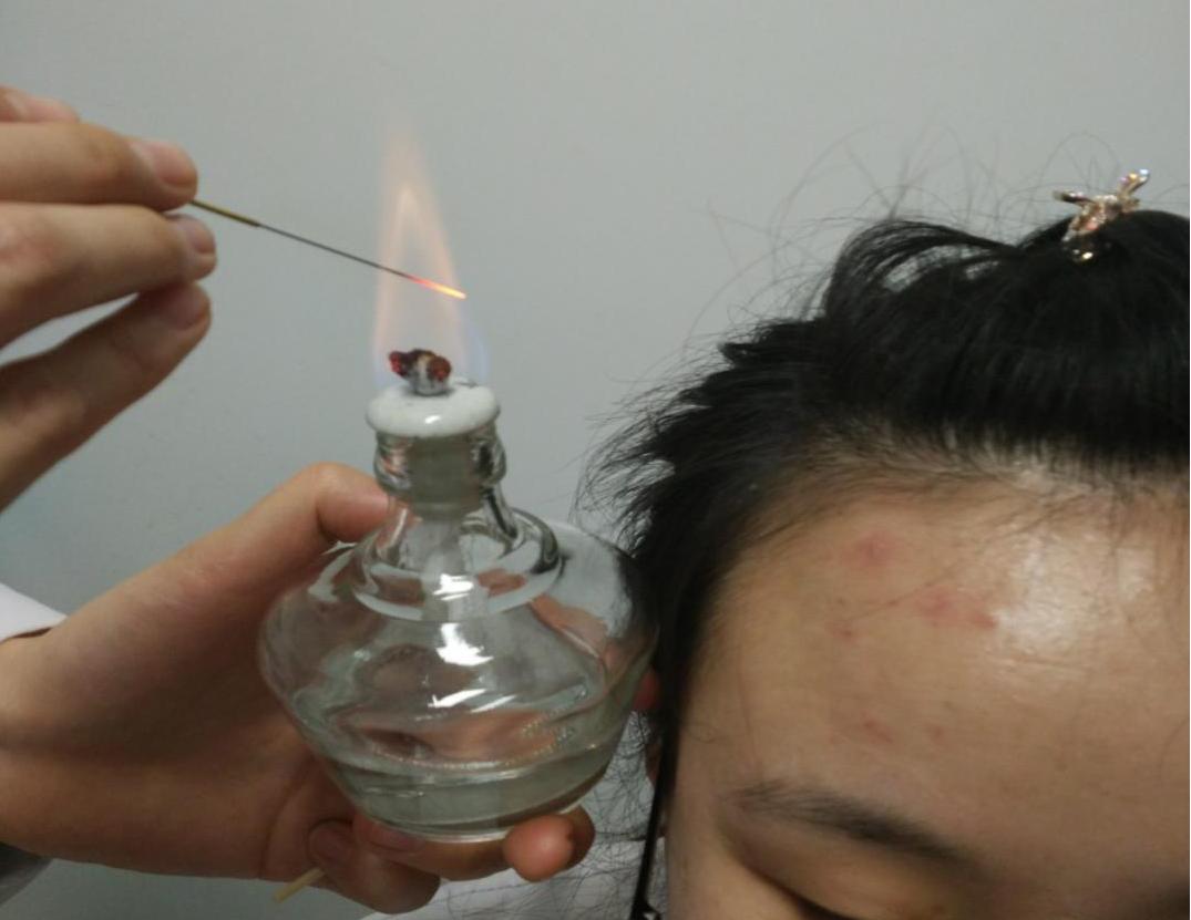 针灸治疗真的靠谱吗,针灸疗法有科学依据吗