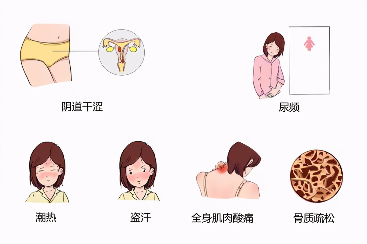 女性更年期的十大症状是真的吗,更年期怎么可以预防衰老